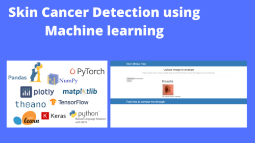 Skin Cancer Detection using Machine learning