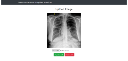 Pneumonia Prediction Using chest x-ray Image Machine Learning - Image 2