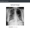 Pneumonia Prediction Using chest x-ray Image Machine Learning
