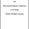Pneumonia Prediction Using chest x-ray Image Machine Learning Project Report