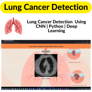 Lung Cancer Detection Lung Cancer Detection Using CNN Project with Source Code