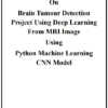 Brain Tumours Detection Project Report